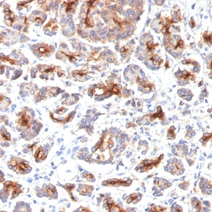 CFTR (Cystic Fibrosis Transmembrane Conductance Regulator); Clone SPM176 (Concentrate)